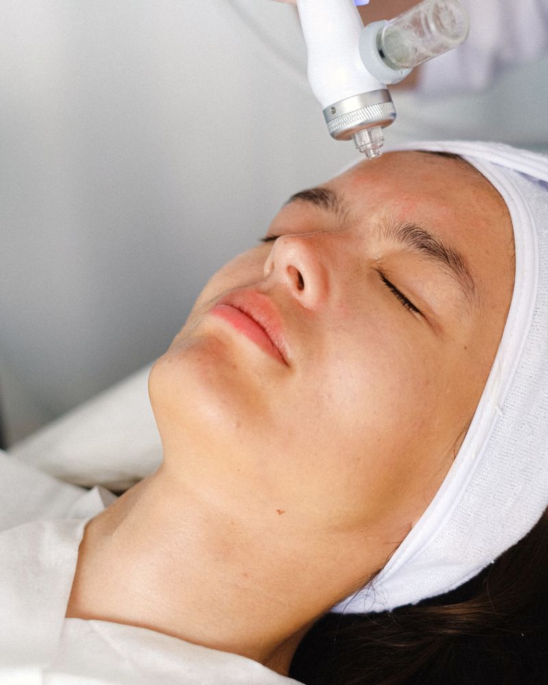 Radiofrequency Facial